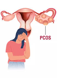 Reverse Pcos