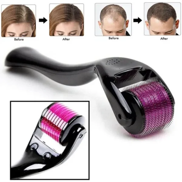 Derma Roller 0.5mm for Hair & Skin Therapy | 540 Titanium Mi